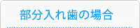 部分入れ歯の場合
