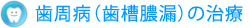 歯周病（歯槽膿漏）の治療